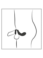 Illustrasjon av prostatavibrator med penisring brukt for prostatastimulering