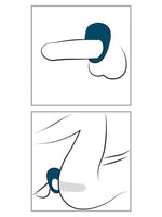 Illustrasjon av hvordan penisring plasseres rundt penis