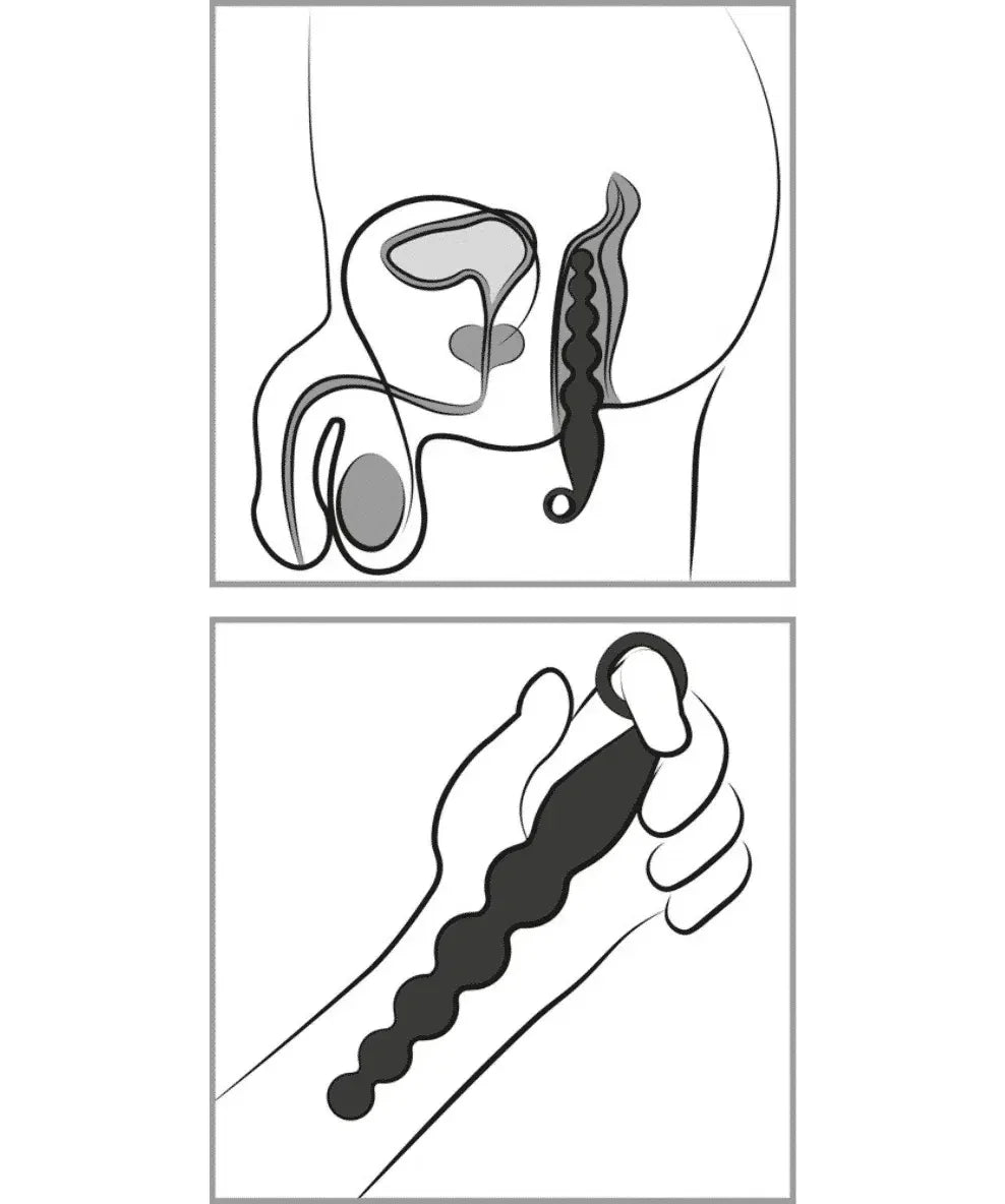 ANOS - Vibrerende Analkuler