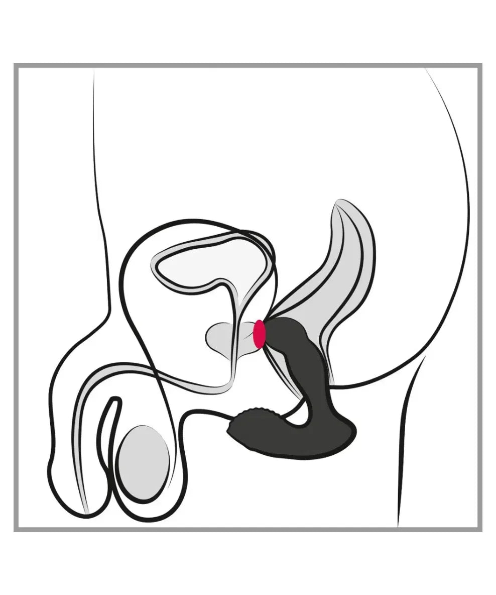 Rebel RC Prostatavibrator
