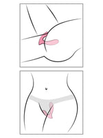 Illustrasjoner som viser bruk av Svakom Erica trusevibrator, sett fra siden i anatomisk tverrsnitt og forfra plassert i undertøy